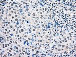 MAPK1 / ERK2 Antibody (clone OTI6F8)
