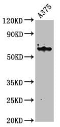 IHC-plus™ KRT6A / CK6A / Cytokeratin 6A Antibody