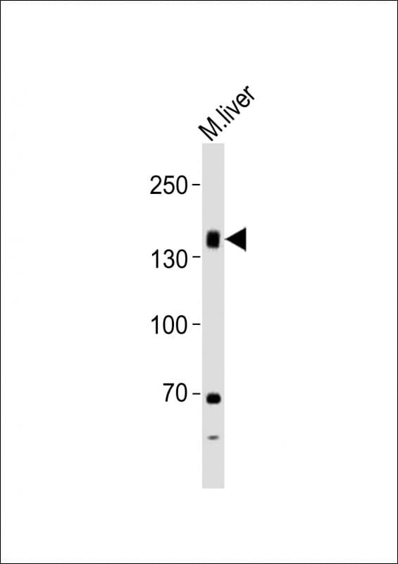 Polyclonal Rabbit anti-Human TSH Receptor / TSHR Antibody (aa217-252, WB)