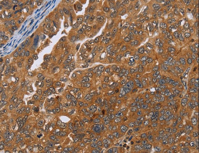 ADAMTS15 Antibody