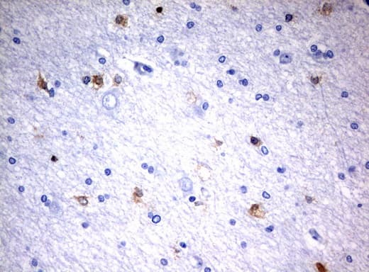 MSI1 / Musashi 1 Antibody (clone UMAB127)