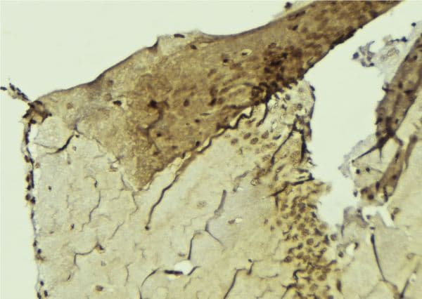 Polyclonal Rabbit anti-Human CNOT4 / CLONE243 Antibody (IHC, IF, WB)