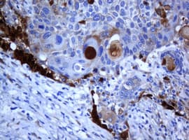 Monoclonal Mouse anti-Human Selenium Binding Protein 1 Antibody (clone OTI3A3, IHC, WB)