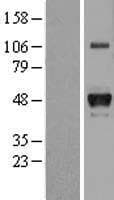 Human HP / Haptoglobin Protein (Over-Expression Lysate Myc-DDK (Flag))