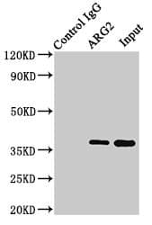 ARG2 / Arginase 2 Antibody (aa1-354)