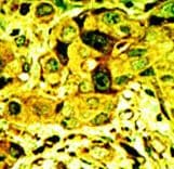 PRKCD / PKC-Delta Antibody (aa298-326)