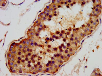 Polyclonal Rabbit anti-Human AMMECR1 Antibody (IHC, IF)