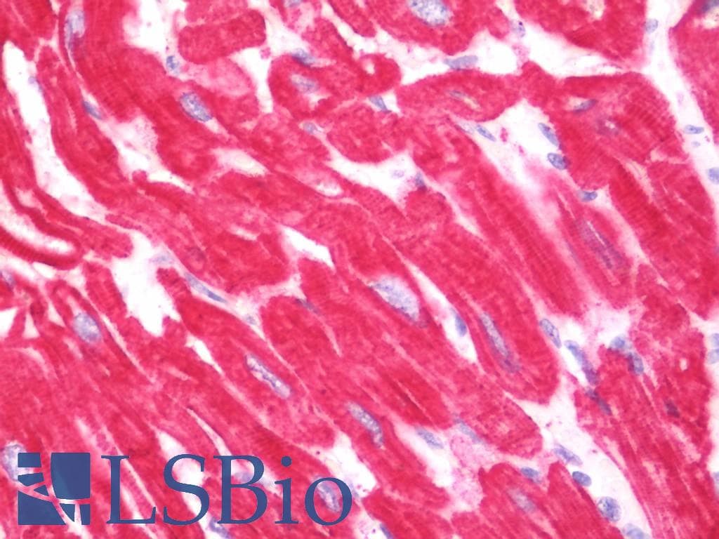 IHC-plus™ ACTC1 / Alpha Cardiac Actin Antibody (aa99-354)