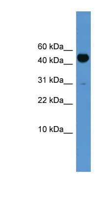 BMP10 Antibody (aa91-140, HRP)