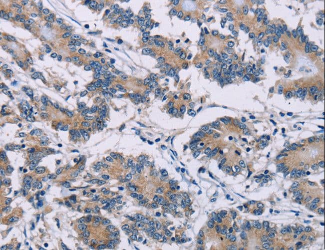 Polyclonal Rabbit anti-Human ODF2 Antibody (IHC, WB)