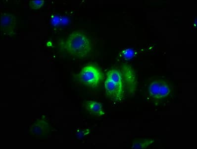 PathPlus™ Polyclonal Rabbit anti-Human CDH1 / E Cadherin Antibody (IHC)