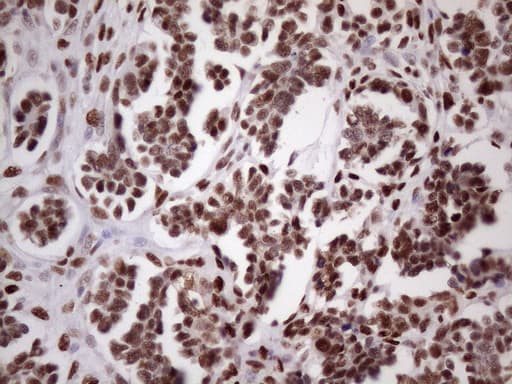 TP53BP1 / 53BP1 Antibody (aa1-300, clone OTI2H6)
