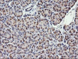 Monoclonal Mouse anti-Human COG6 Antibody (clone OTI1B8, IHC, IF, WB)