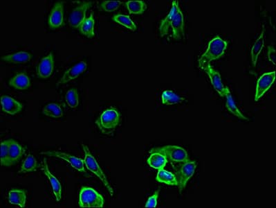 SNAI2 / SLUG Antibody