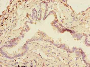 SMIF / DCP1A Antibody