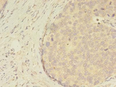 Polyclonal Rabbit anti-Human ATXN7L3 Antibody (IHC)