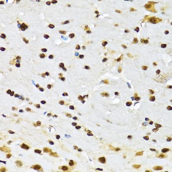 CCAR2 / KIAA1967 Antibody