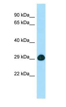 SLC25A2 Antibody (aa181-230)