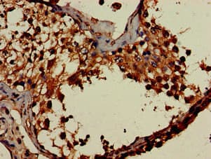 DOT1L / DOT1 Antibody