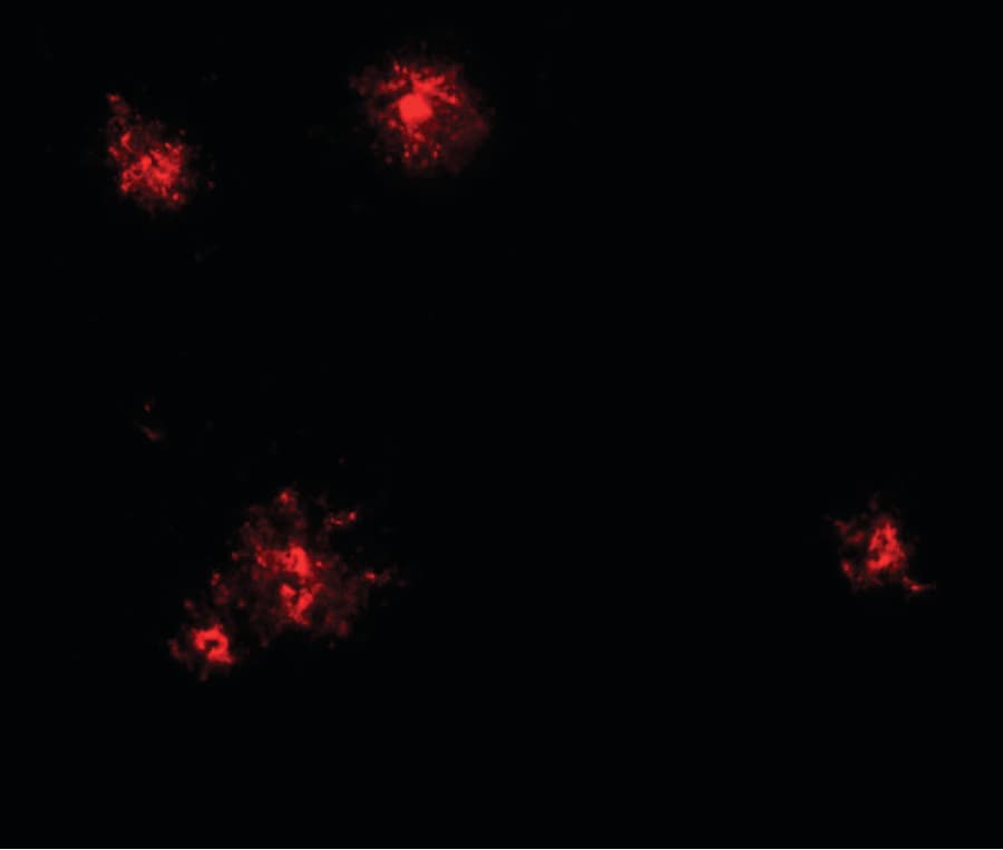 Polyclonal Rabbit anti-Human CCL2 / MCP1 Antibody (IHC, IF, WB)