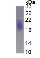 stem cell factor {alternatively spliced} [human, preimplantation embryos, blastocysts, mRNA Partial, 180 nt]. Protein (Recombinant)