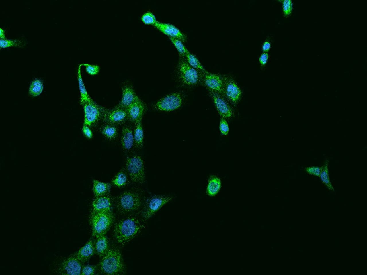 SUCLG1 / GALPHA Antibody
