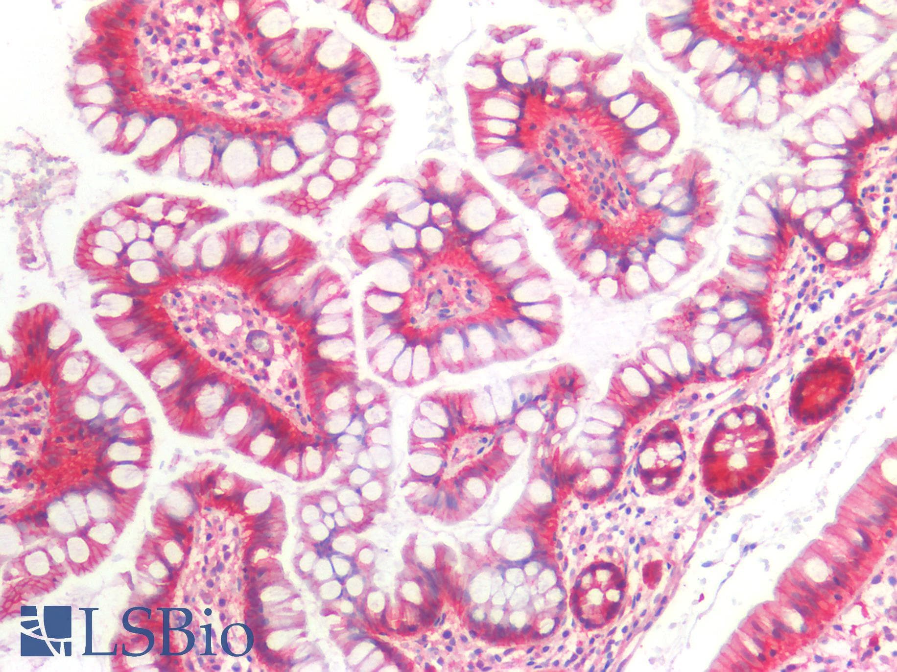 IHC-plus™ Monoclonal Mouse anti-Human CTNNB1 / Beta Catenin Antibody (IHC, WB)
