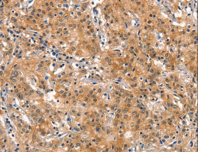 DNM2 / Dynamin-2 Antibody