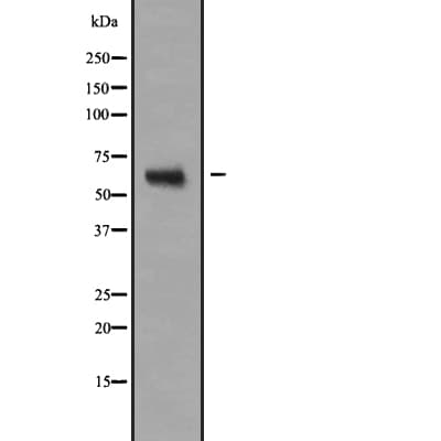 NR2C2 / TAK1 Antibody