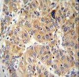 Polyclonal Rabbit anti-Human NARS Antibody (aa24-53, IHC, WB)