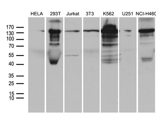 SMC1A / SMC1 Antibody (aa889-1016, clone OTI5A1)