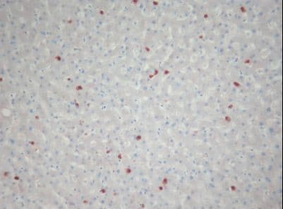 Monoclonal Mouse anti-Human S100A9 / MRP14 Antibody (clone S36-48, IHC)