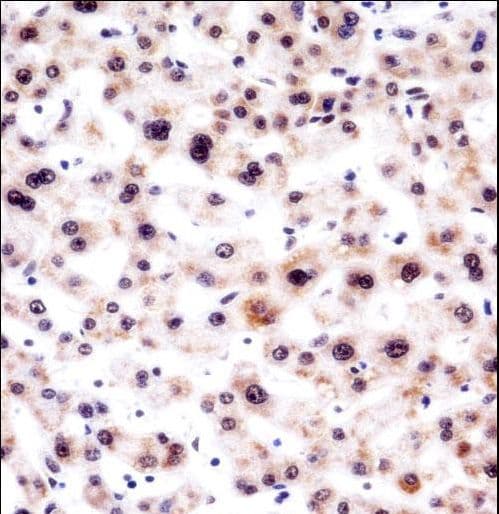 SNRPA / U1A Antibody (aa83-111)