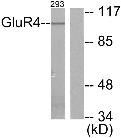 IHC-plus™ Polyclonal Rabbit anti-Human GRM4 / MGLUR4 Antibody (aa851-900, IHC, WB)