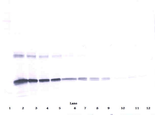 IL6 / Interleukin 6 Antibody