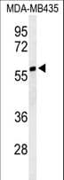 Polyclonal Rabbit anti-Human IOP1 / NARFL Antibody (aa240-269, WB)