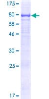 Human TMEM200A Protein (Recombinant GST)