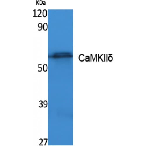 CAMK2D / CaMKII Delta Antibody (Internal)