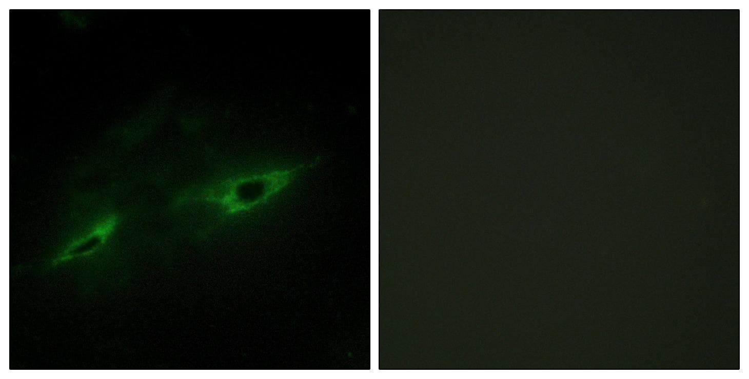 Polyclonal Rabbit anti-Human CDH22 / Cadherin 22 Antibody (IHC, IF, WB)