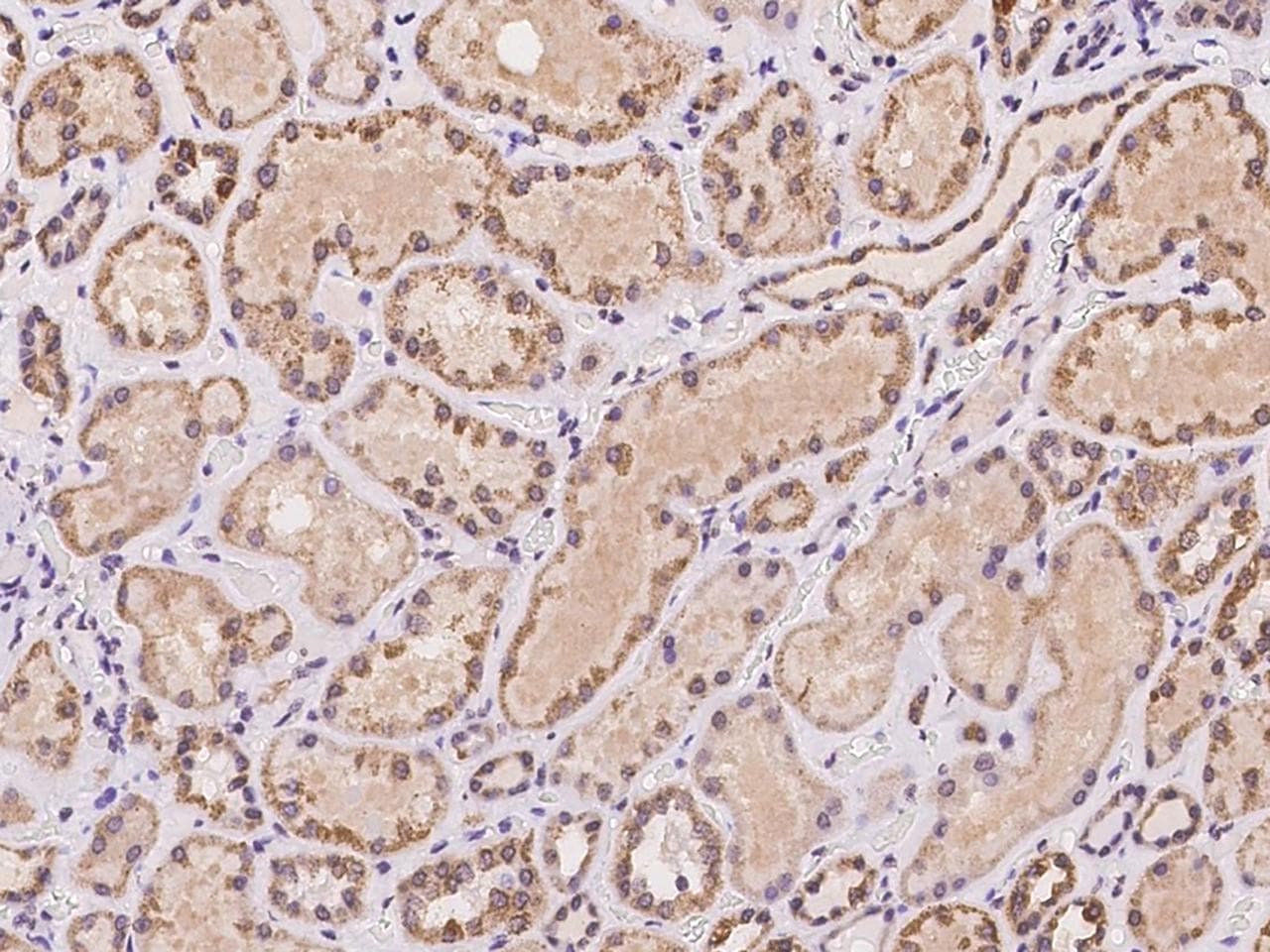 AKAP7 Antibody