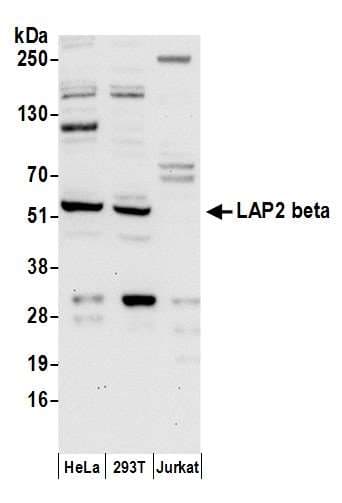 TMPO / TP / Thymopoietin Antibody (aa300-350)