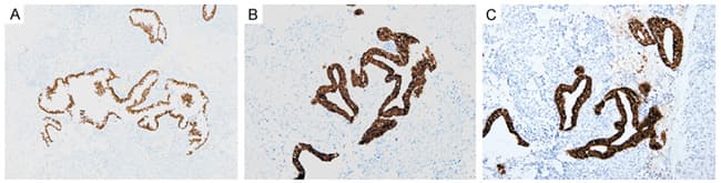 KRT18 / CK18 / Cytokeratin 18 Antibody (aa69-372, clone UMAB50)