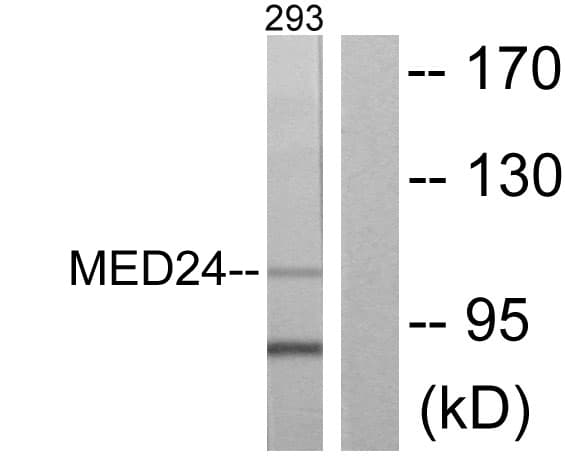 MED24 / TRAP100 Antibody (aa801-850)