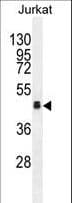 Polyclonal Rabbit anti-Human OR4N4 Antibody (aa68-96, WB)