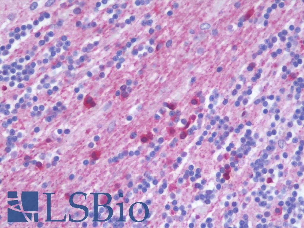 IHC-plus™ Polyclonal Rabbit anti-Human SEPT7 / Septin 7 Antibody (aa350-399, IHC, WB)