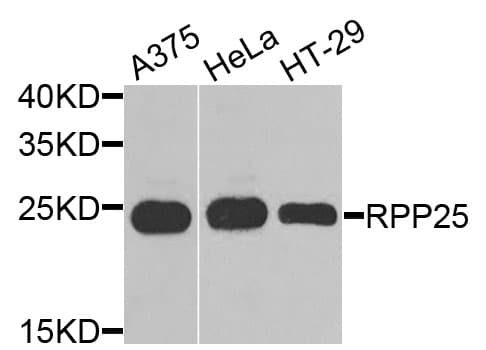 Polyclonal Rabbit anti-Human RPP25 Antibody (WB)