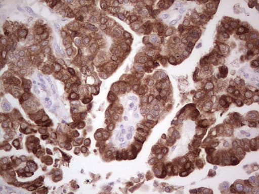 PTGS2 / COX2 / COX-2 Antibody (aa18-260, clone OTI5F12)