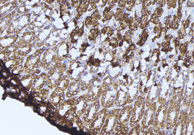 DAO / D Amino Acid Oxidase Antibody