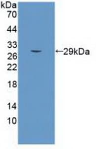 SEMA5B / Semaphorin 5B Antibody (aa36-161, PE)