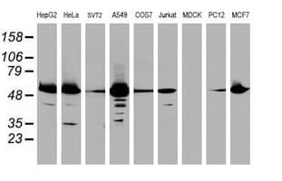 EPHX1 / Epoxide Hydrolase 1 Antibody (clone OTI3F10)